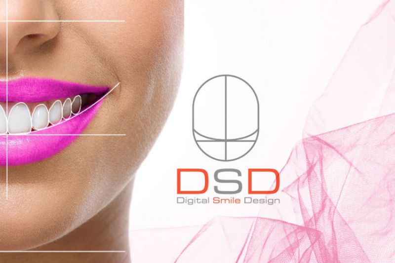 Digital Smile Design