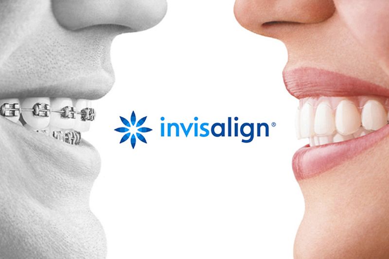 Ortodòncia invisible (INVISALIGN)