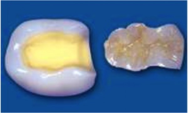 Odontologia conservadora