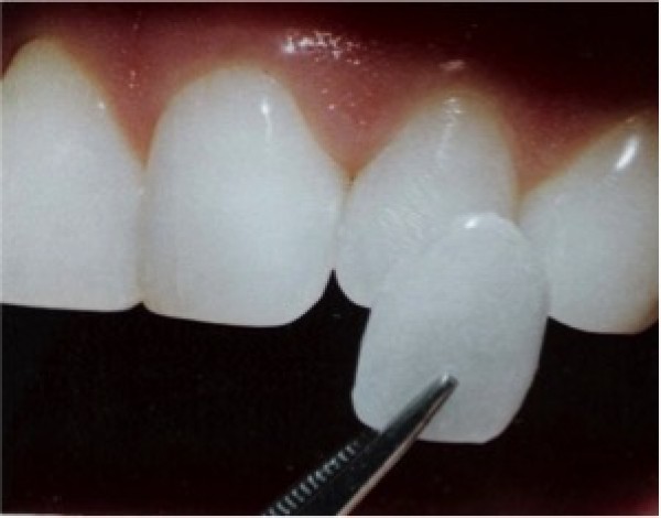 Odontologia estètica