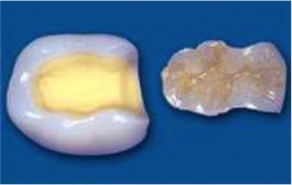 Odontologia estètica