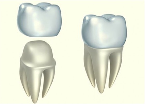 Pròtesi dentals