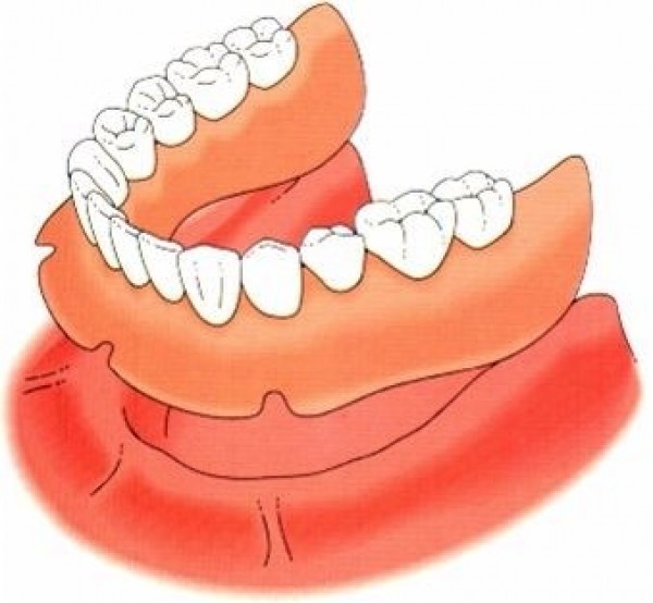 Pròtesi dentals