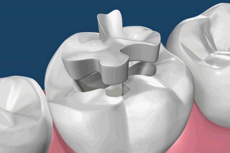 Odontologia conservadora